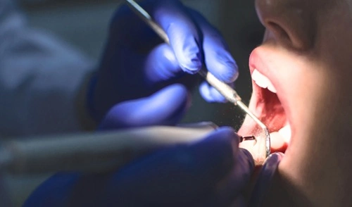 Tooth Worth in a Lawsuit