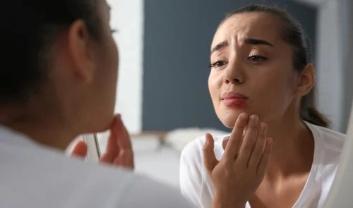 Giving Someone Herpes